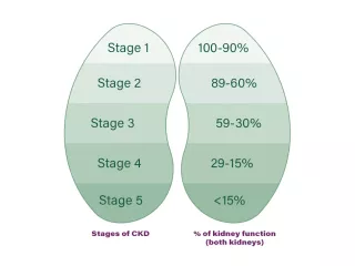 Stages of CKD as characterized by percentage of kidney function, with stage 5 having less than 15 percent function
